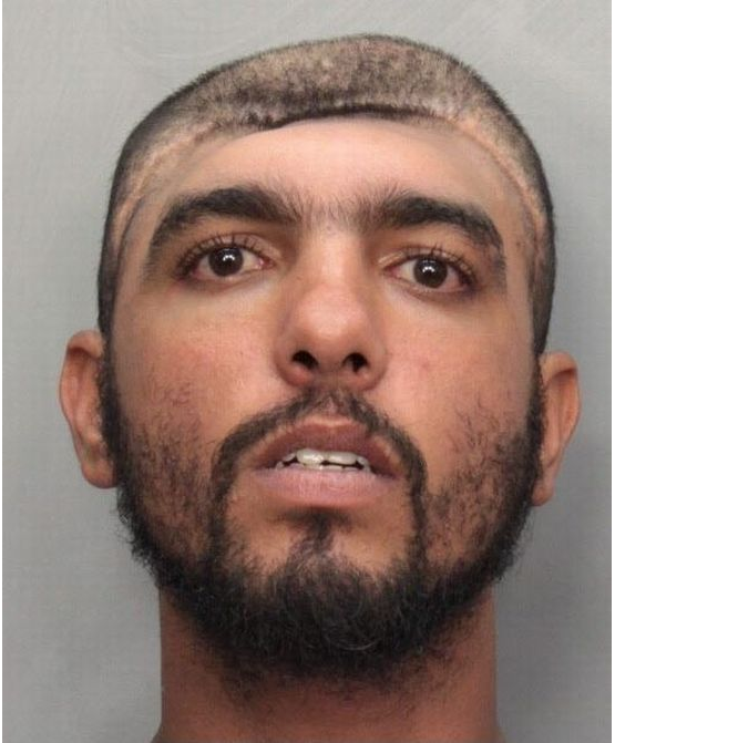 Miami man half head